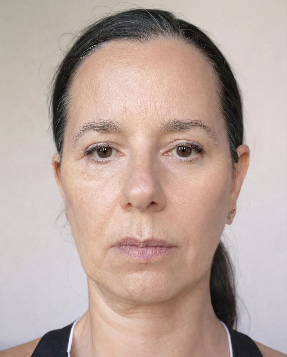 Rostro antes del cepillado de drenaje linfático